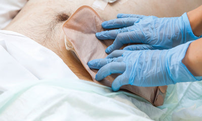 13 Easy Steps On Changing The Ostomy Pouch