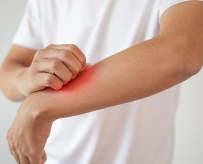 Four Tips For Relieving Itching Skin Caused By Diabetes