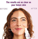 Think Smarter Products Eczema & Psoriasis Therapy with Hypochlorous Acid 81965432