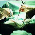 Jackson-Pratt SU130-1323 Wound Drains without Trocar 15Fr 3/16, Round Silicone, 1 Each