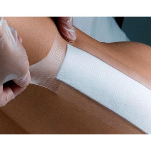 Opsite Smith & Nephew Post Op Transparent Waterproof Dressing: 8" x 4", 20 Count, Sterile Transparent 15631442
