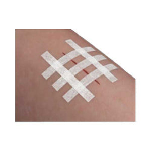 McKesson 3010 Skin Closure Strip, Case of 200 64435940