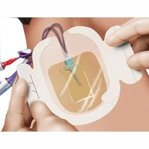 3M Tegaderm 1657 I.V. Securment Dressing 3 1/2 X 4 1/2 Inch